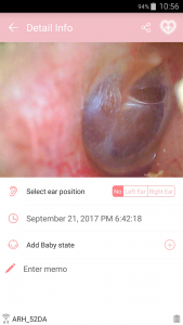 scalp and hair analysis system
