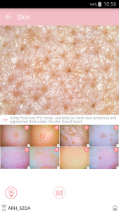 hair and scalp analysis