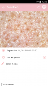 hair and scalp analysis