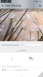 skin analysis device