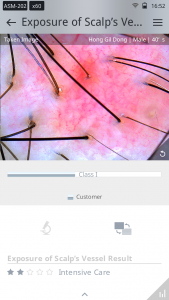 skin analysis device