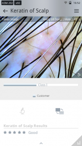 skin analysis device