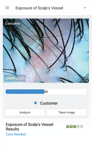 skin analysis device