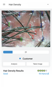 skin analysis device