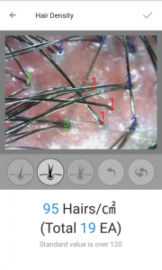 skin analysis device