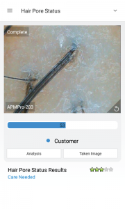 skin analysis device