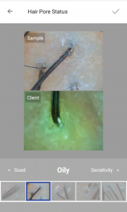 skin analysis device