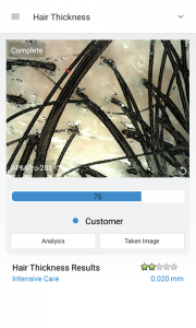 skin analysis device