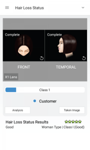 skin analysis device
