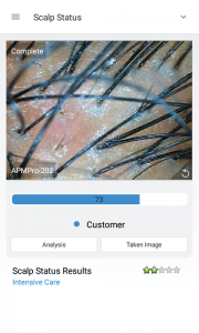 skin analysis device
