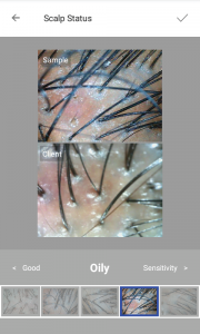 skin analysis device
