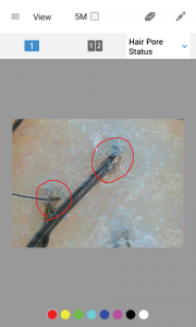 hair and scalp analysis