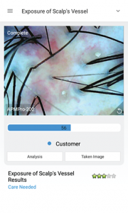 hair and scalp analysis