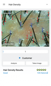 hair and scalp analysis