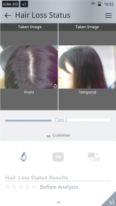 hair and scalp analysis