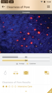 hair and scalp analysis