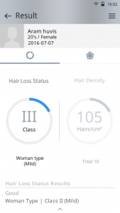 scalp analysis device
