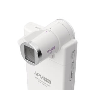 skin analyzer device