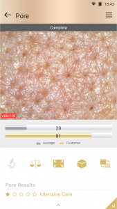 scalp analysis device
