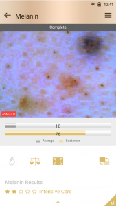 scalp analysis device