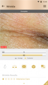 scalp analysis device