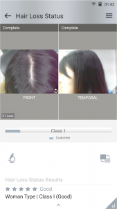 hair scalp analyzer