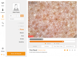 skin analyzer device