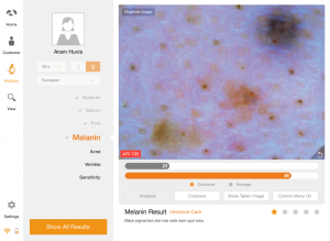 skin analyzer device