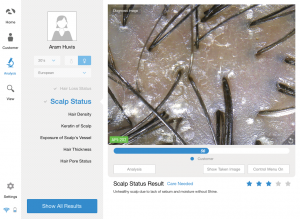 hair scalp analyzer