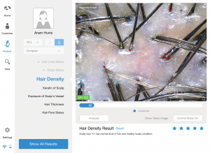 scalp analyzer
