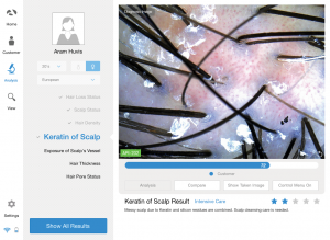scalp analyzer