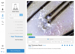 scalp analyzer