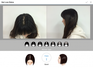 scalp analyzer