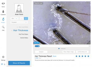 scalp analyzer