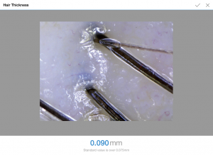scalp analyzer