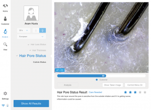 scalp analyzer