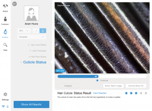 hair scalp analyzer