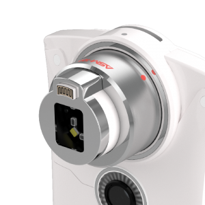 skin analyzer device