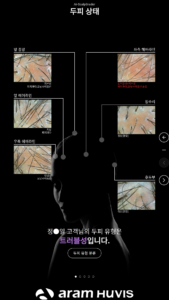 skin and hair analyzer