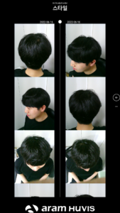customized scalp care