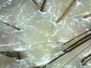 customized scalp care