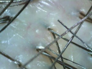 customized scalp care
