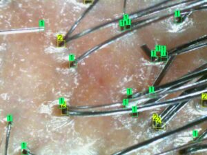 customized scalp care