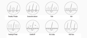 ai scalp grader