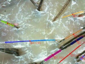 ai scalp grader