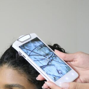 hair density analysis