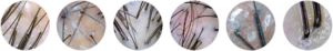 scalp and hair analysis system
