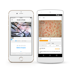 scalp and hair analysis system